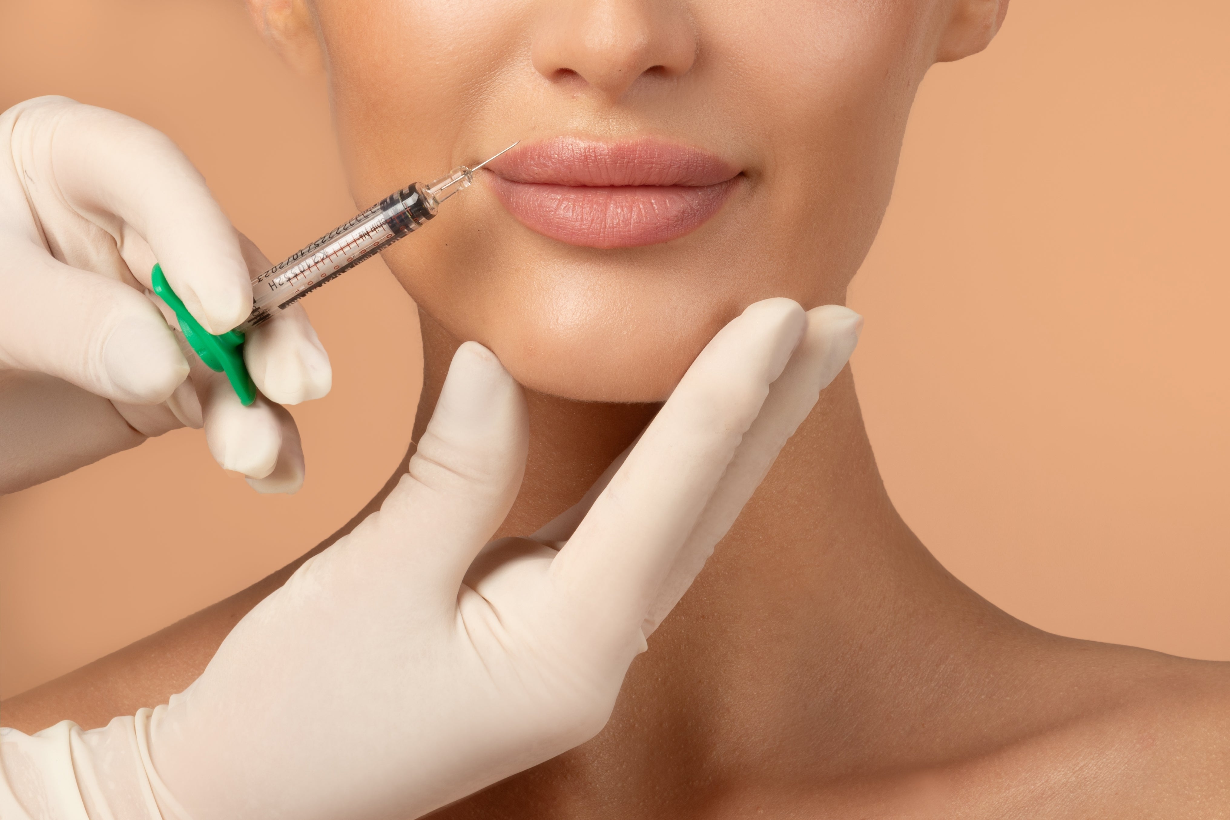 A woman, during a lip filler injection from a dermatologist, enhances the volume and shape of her lips.