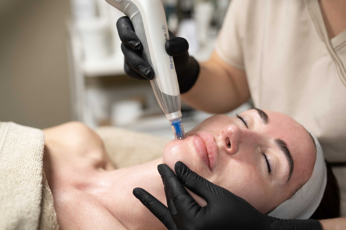 Dermapen microneedling treatment performed at BROWZ to improve skin texture and stimulate collagen.