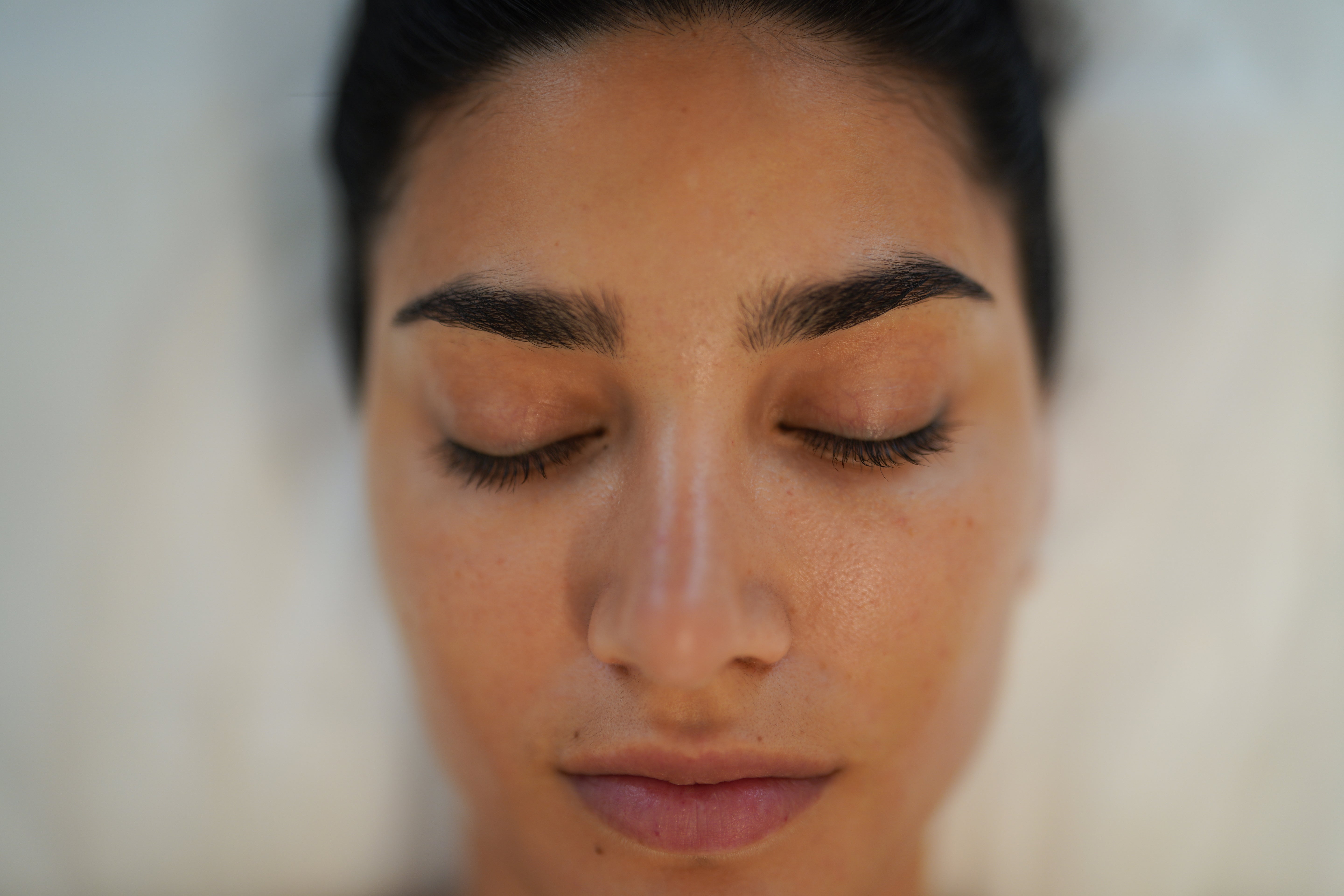 Close-up of a woman’s face before PRP treatment at BROWZ Dubai, showing natural skin condition prior to rejuvenation treatment.