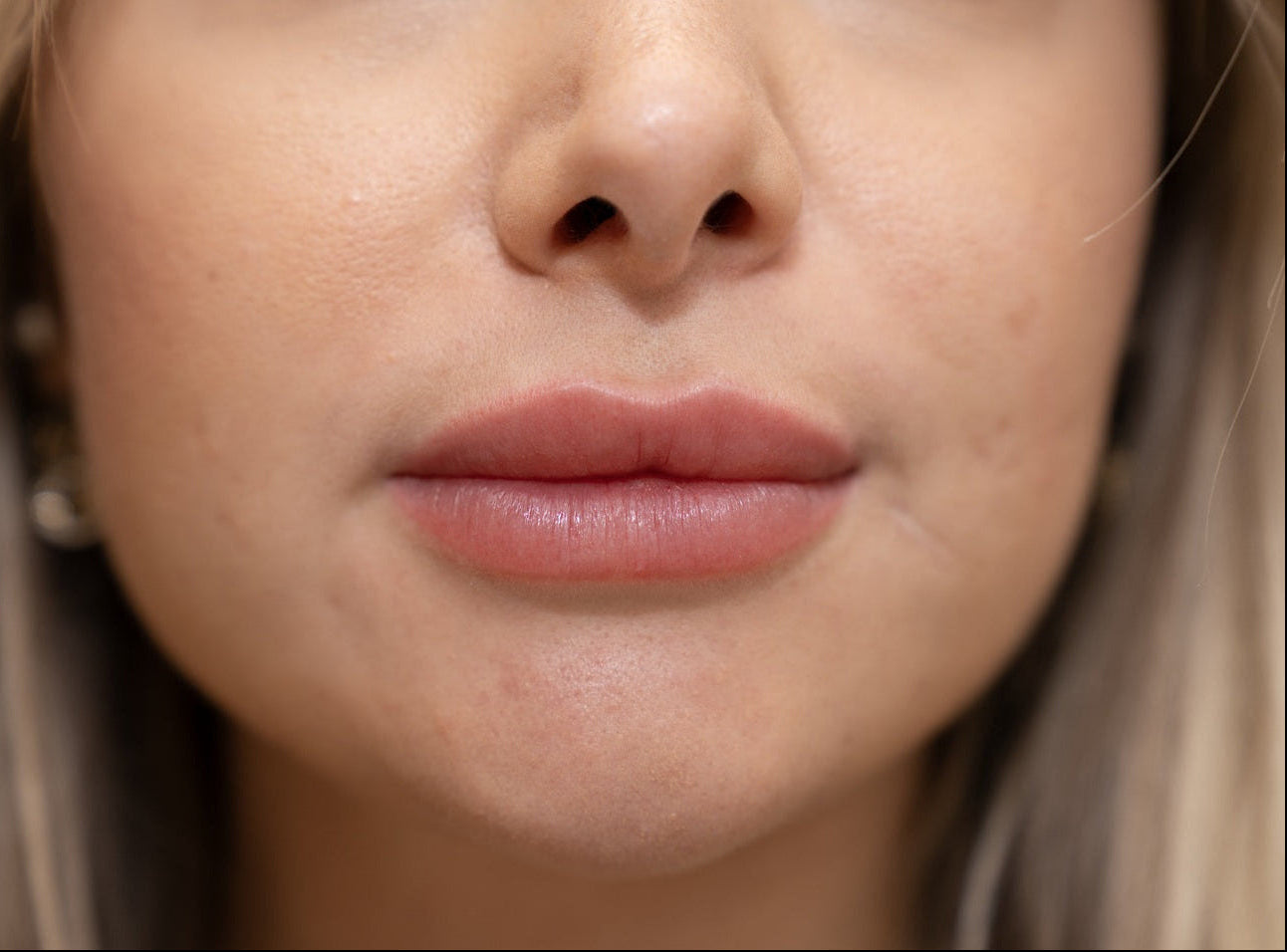 After lip blush Dubai showing enhanced colour, improved symmetry, defined borders, hydrated appearance, and healthy natural glow.