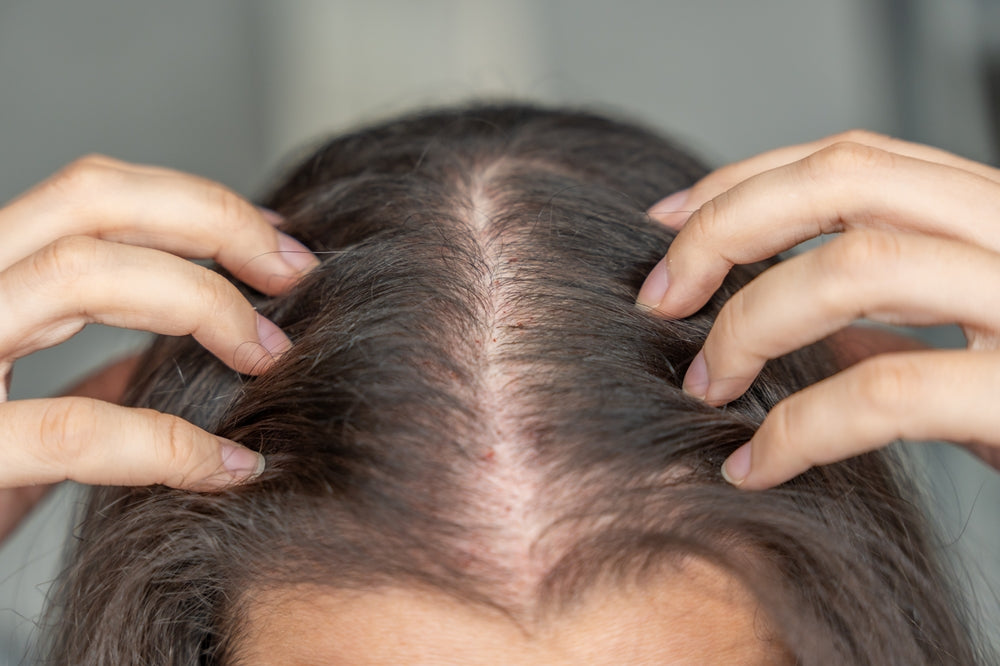 Close-up of client’s scalp showing mild redness and traces of blood after PRP treatment, with post-care guidance at BROWZ in Dubai