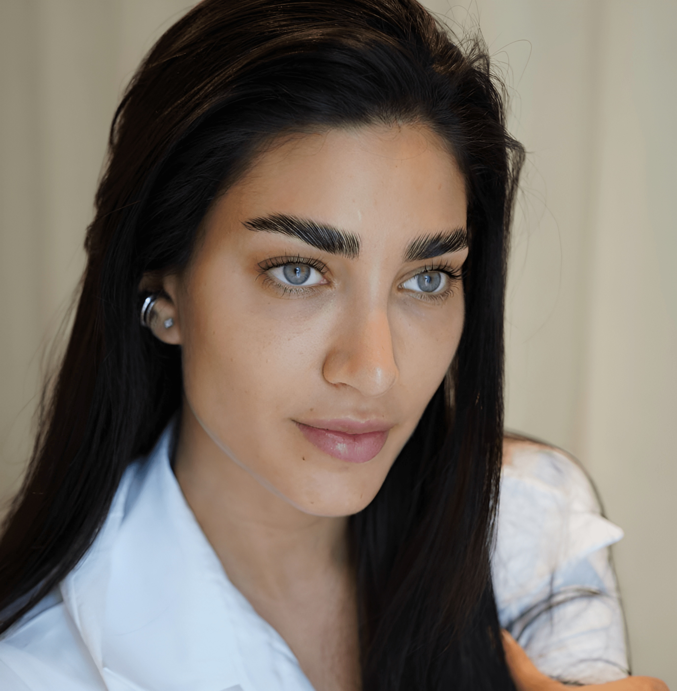 After exosome treatment at BROWZ, enhancing skin rejuvenation and speeding up regeneration for more noticeable results