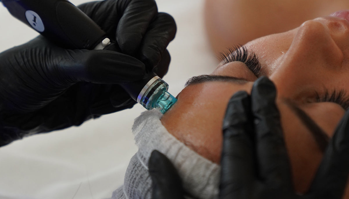 صورة مقربة لعلاج HydraFacial يتم إجراؤه على الجبهة باستخدام جهاز شفط.
