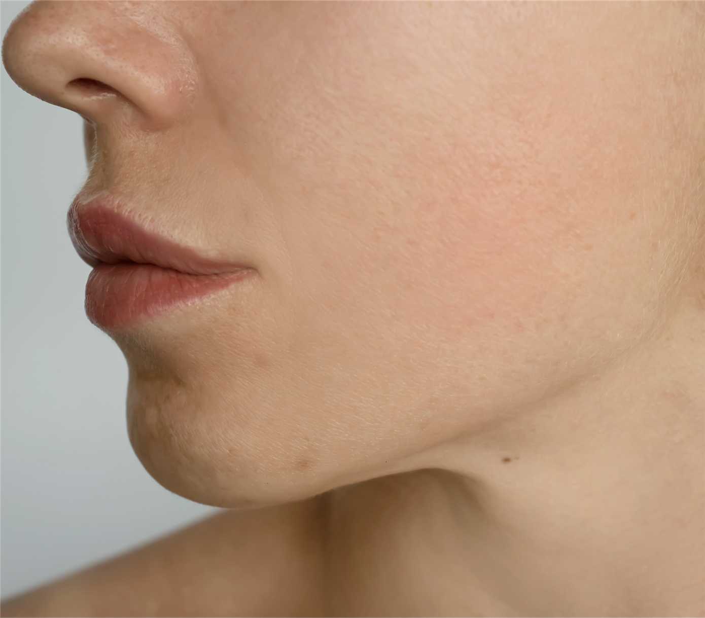 Side view of skin showing improved texture and firmness after Profhilo treatment.