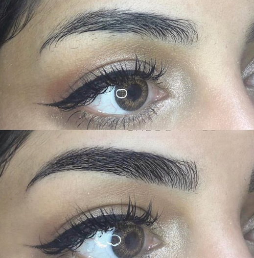 Eyebrow Treatments For Getting the Perfect Brows