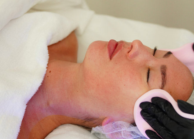 CO2 Facials for Dark Spots and Hyperpigmentation: How Effective Is It?