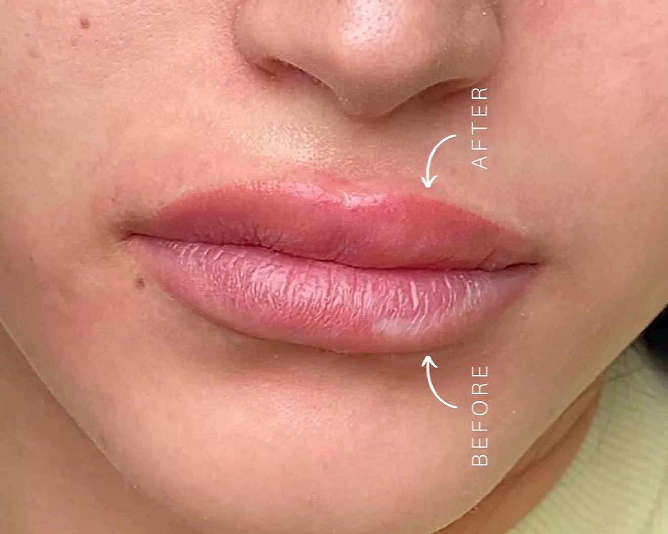 Uncover The Numerous Benefits Of Semi-Permanent Lip Blush