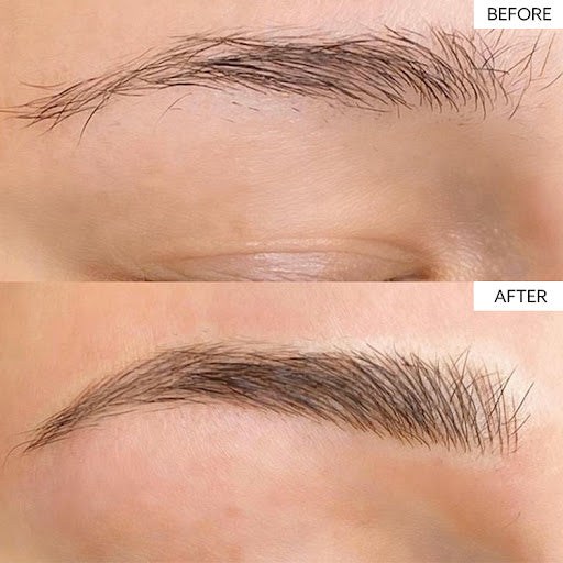 Why HD Brows Are A Trending Brow Treatments