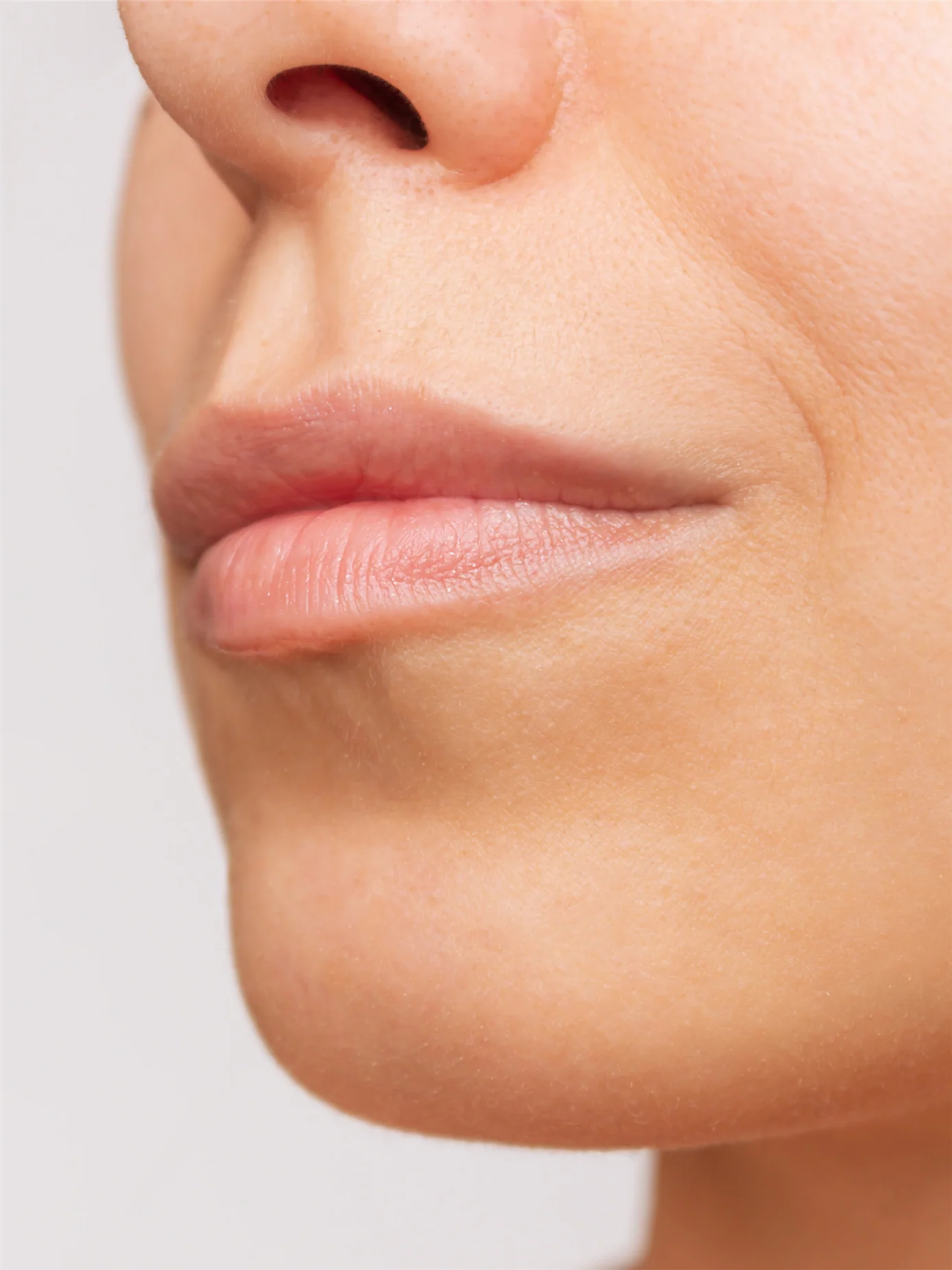 Fotona LipLase - Enhanced Lip Definition and Symmetry | Before