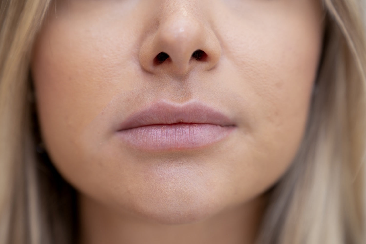Before lip blush Dubai shows with faded colour, lack of definition, highlighting natural texture, and pigmentation imbalance.