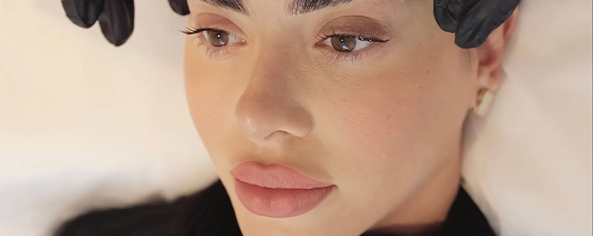 Two weeks after Botox at BROWZ Dubai, post-treatment care ensures lasting results and supports recovery from your injection.