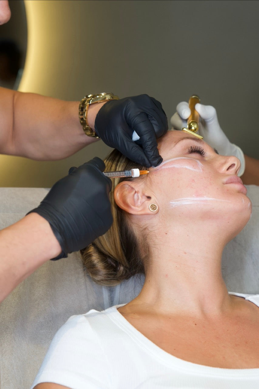 A professional administering Radiesse injection to a woman's face for facial rejuvenation, showcasing a non-invasive treatment.