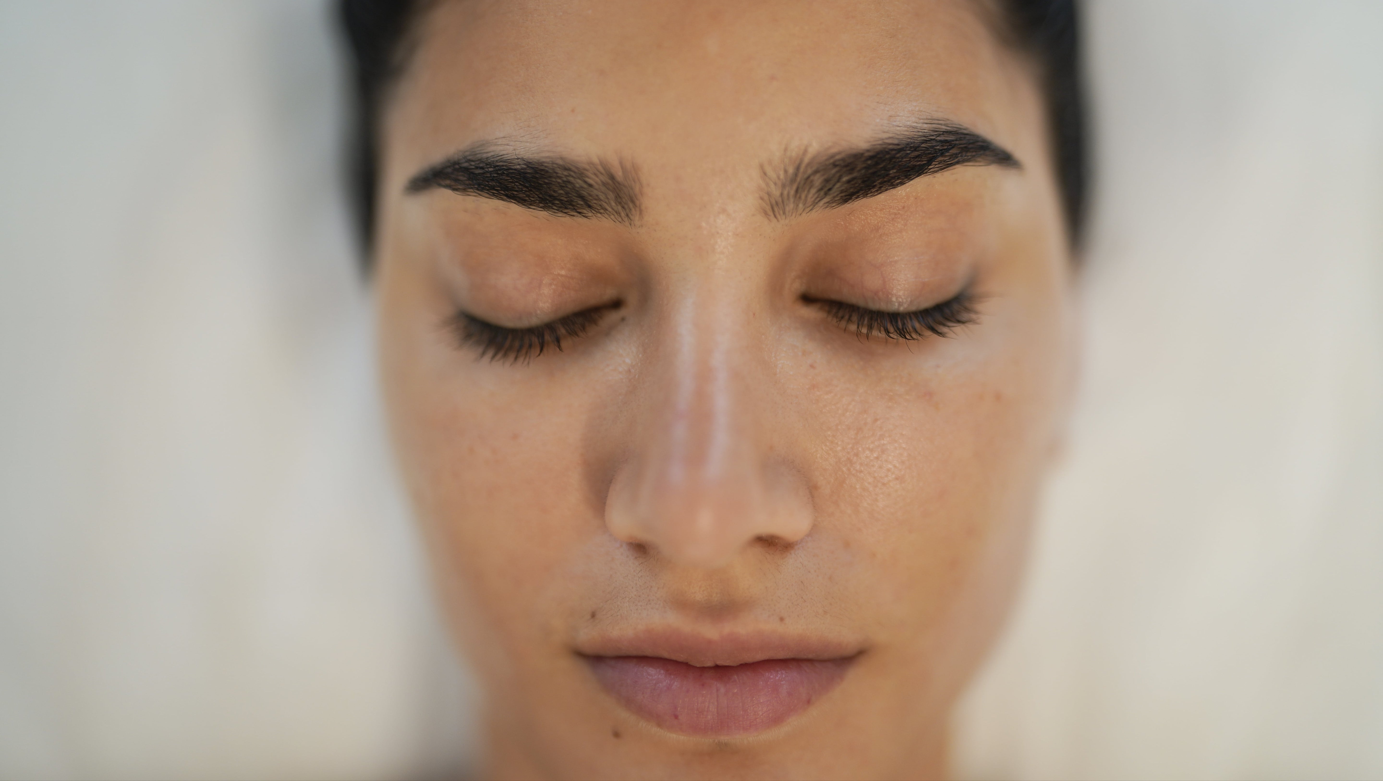 Woman’s face after Mesotherapy treatment at BROWZ, showing smoother texture, brighter tone, hydration, and youthful radiance
