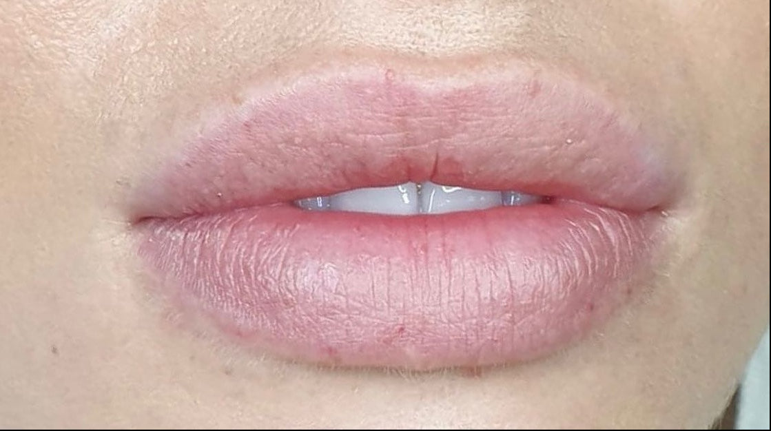 Before lip blush Dubai shows with faded colour, lack of definition, highlighting natural texture, and pigmentation imbalance.