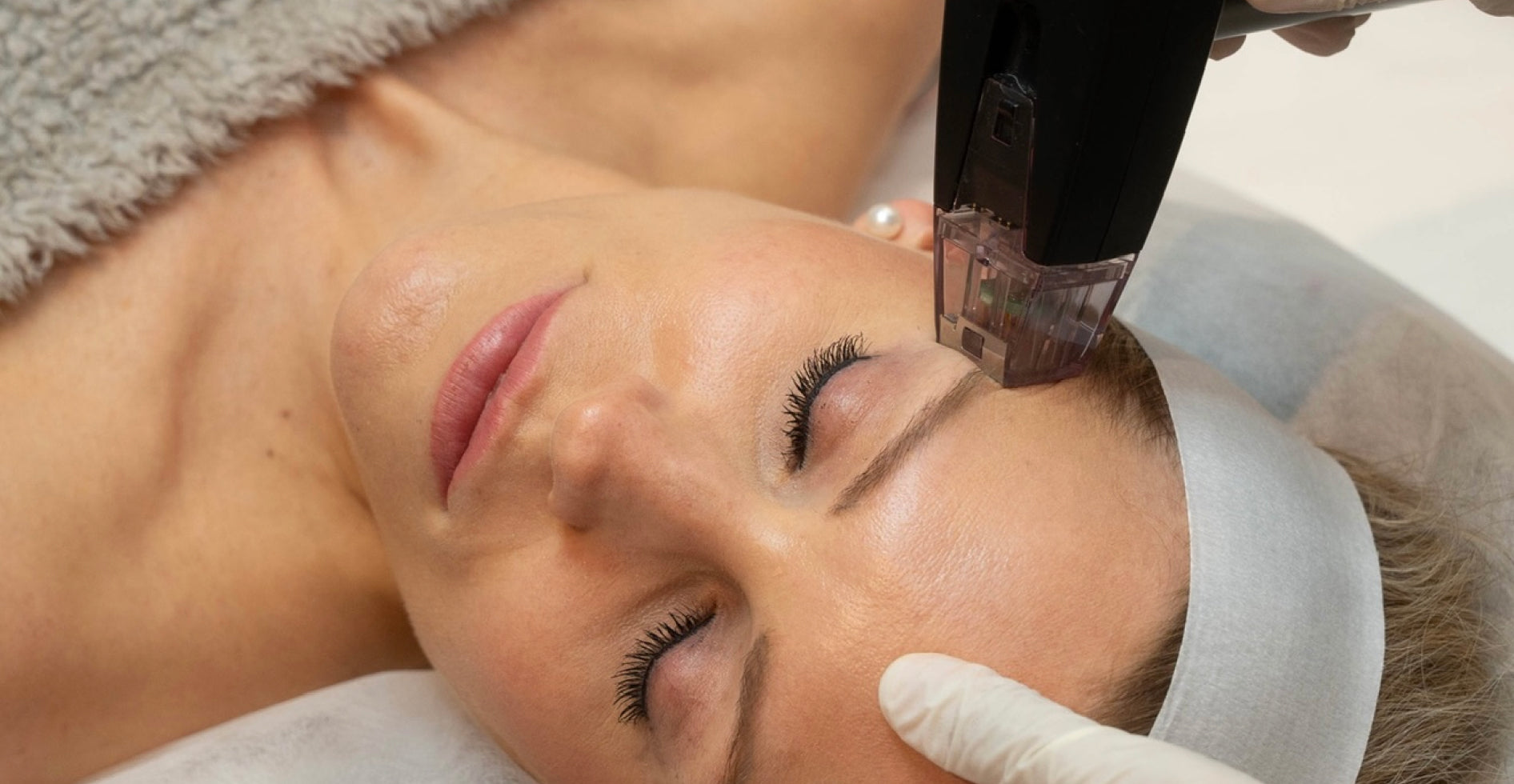 Morpheus8 Treatment | Microneedling & RF for Skin Rejuvenation