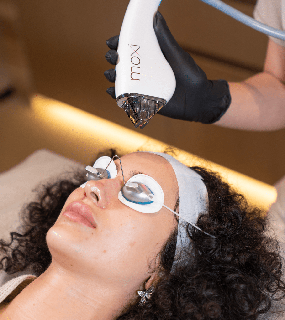 Moxi Laser treatment at BROWZ, targeting specific areas to stimulate collagen production for smoother, resurfaced skin