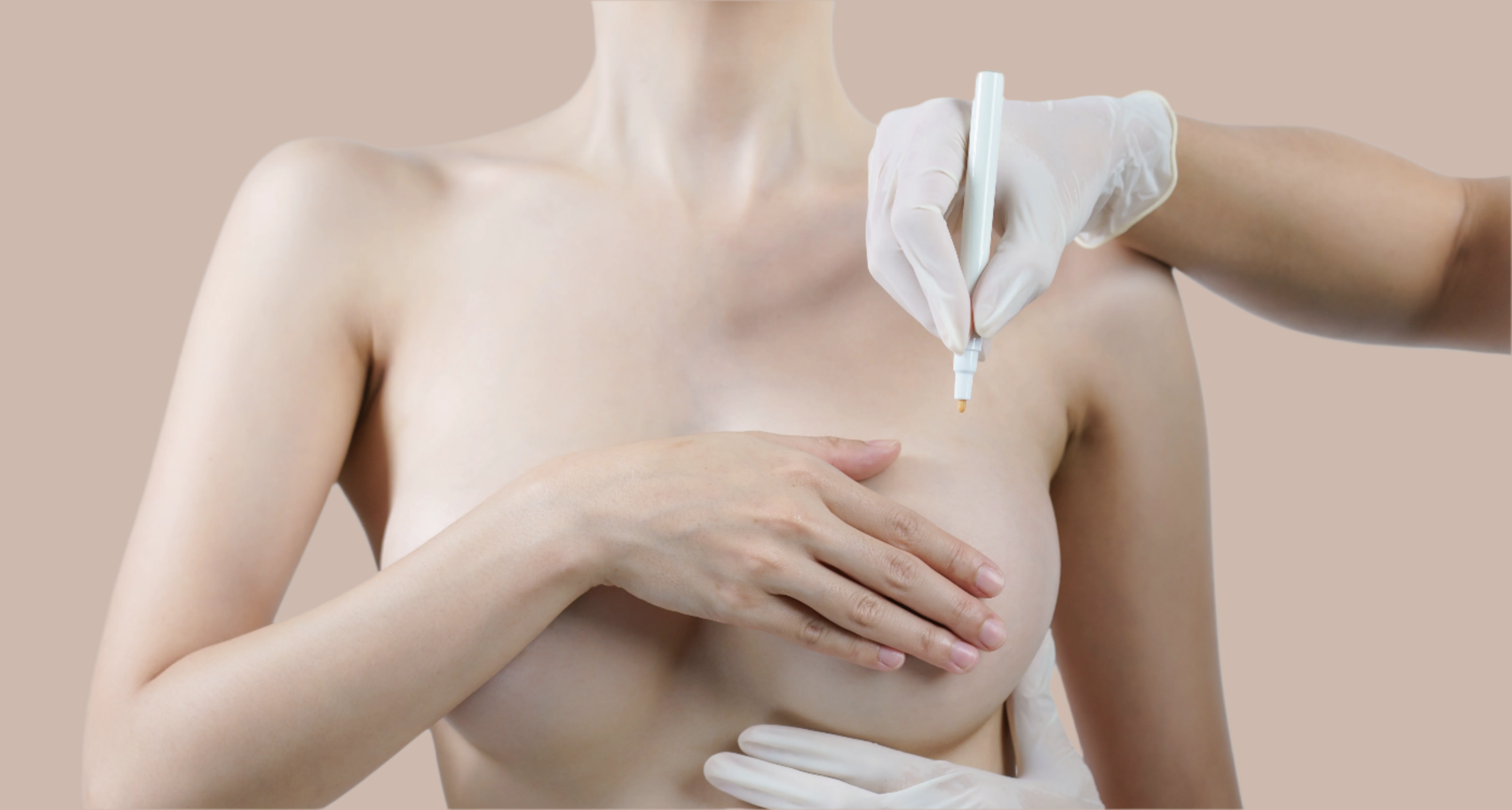 Breast Reduction in Dubai: Relieve Discomfort & Reshape Safely