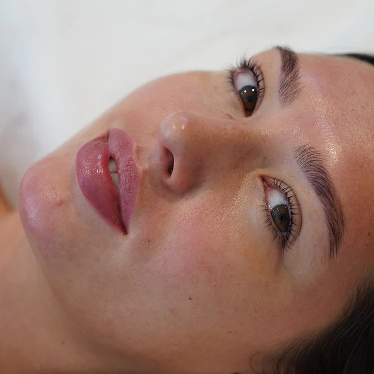 Moxi Laser treatment reveals smoother, healthier skin with a brighter tone and reduced blemishes by BROWZ in Dubai