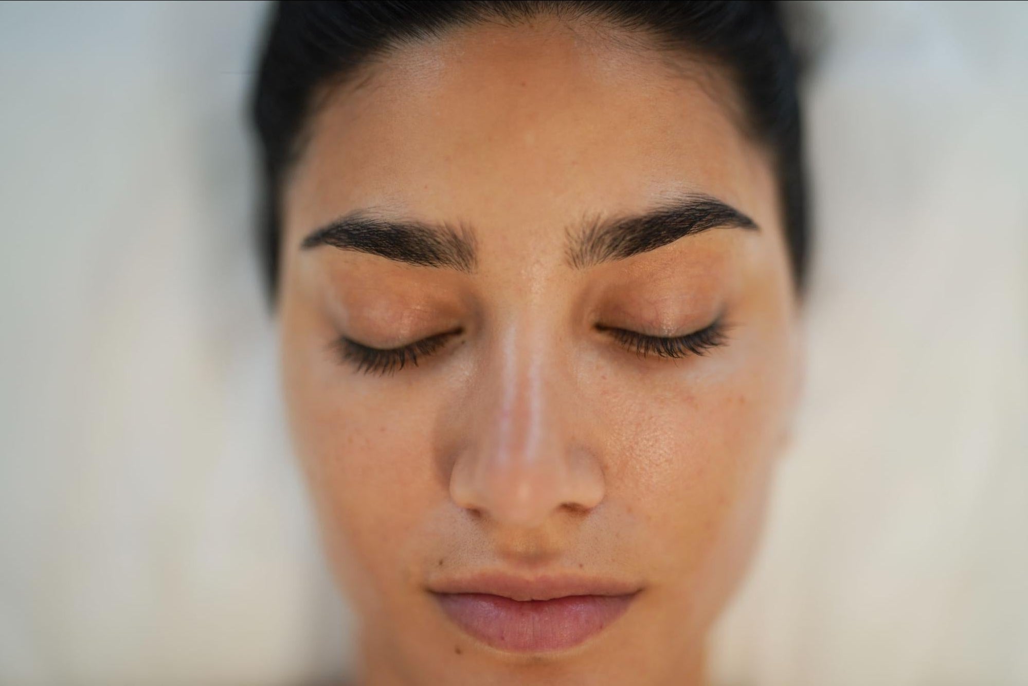 Client after PRF under-eye treatment at BROWZ showing brighter under-eye with reduced dark circles and enhanced appearance
