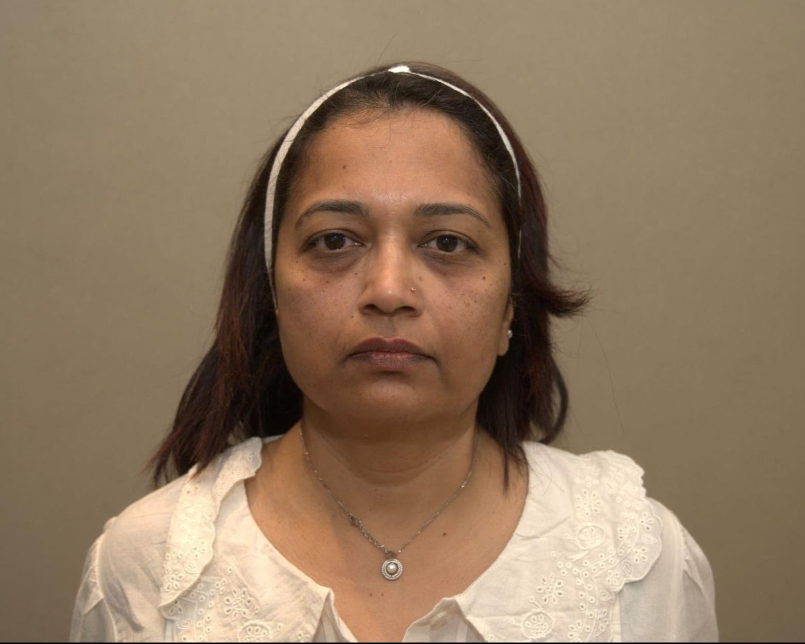 After results of PRF under eyes treatment at BROWZ Dubai showing reduced dark circles and improved skin rejuvenation.