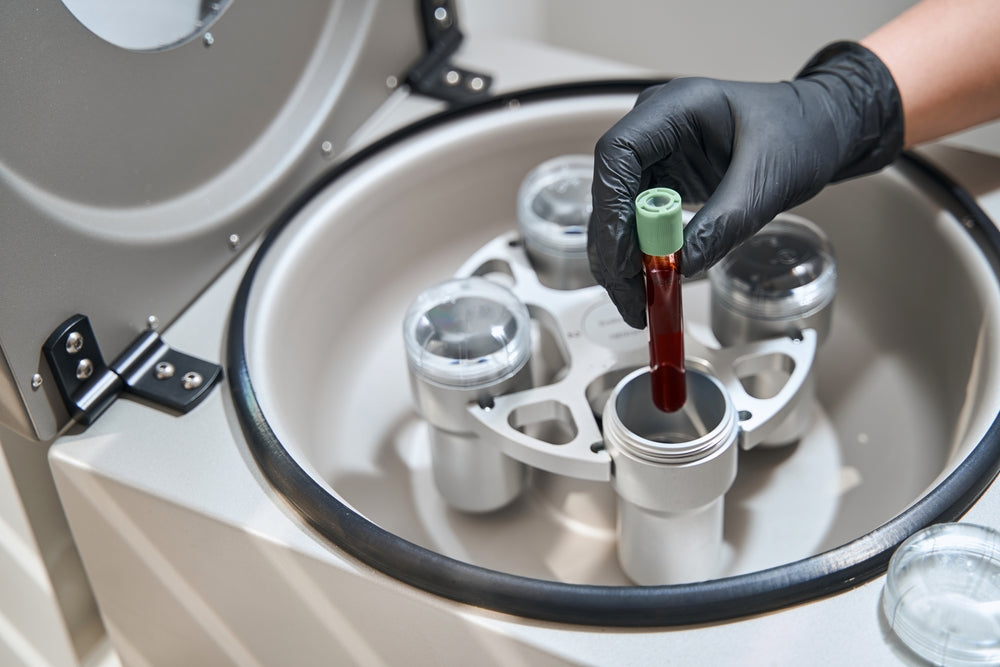 Blood processed for PRF under-eye treatment at BROWZ Dubai, creating natural plasma rich in growth factors for skin rejuvenation.