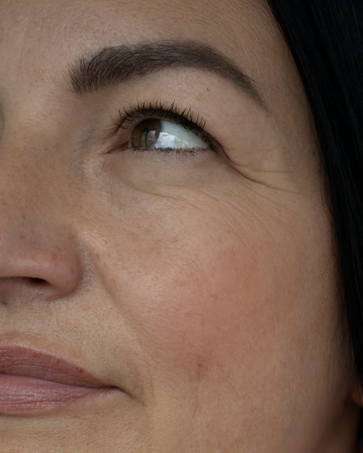 
Woman’s face before EMFace treatment at BROWZ, Dubai showing sagging skin and wrinkles in need of tightening and rejuvenation.