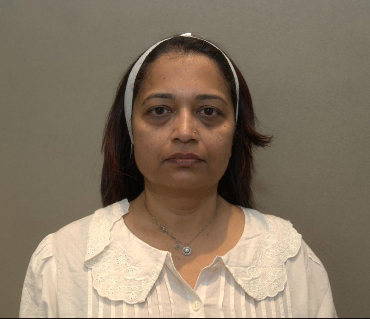 Before PRF under-eye treatment at BROWZ Dubai, the patient showed dark circles, tired under-eye skin, fine lines, and puffiness.
