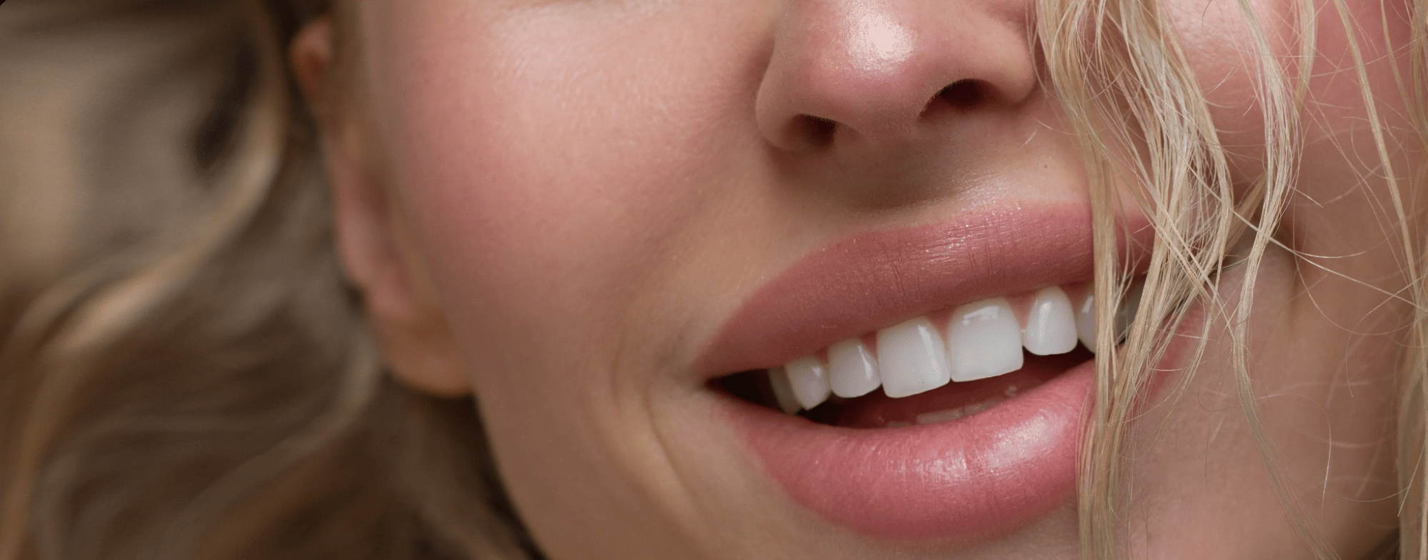 Close-up of a woman's radiant smile, representing the glow achieved after chin filler and lip filler treatment at BROWZ in Dubai.