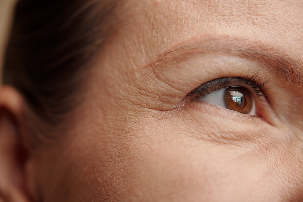 A woman’s face showing fine lines and wrinkles, demonstrating how PRP treatment at BROWZ help with skin texture and firmness.