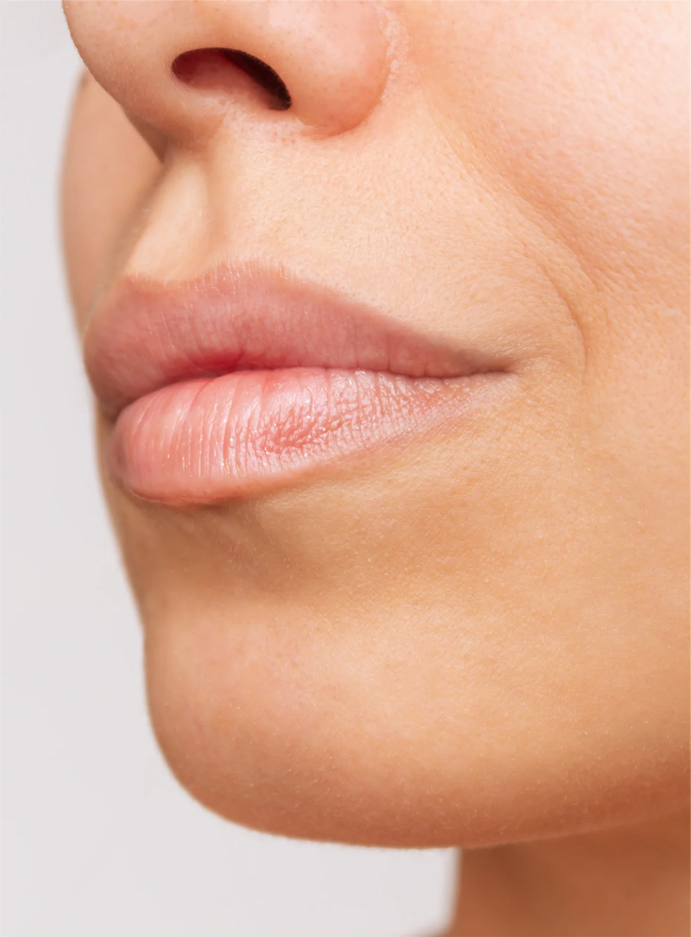 Fotona LipLase - Enhanced Lip Definition and Symmetry | After