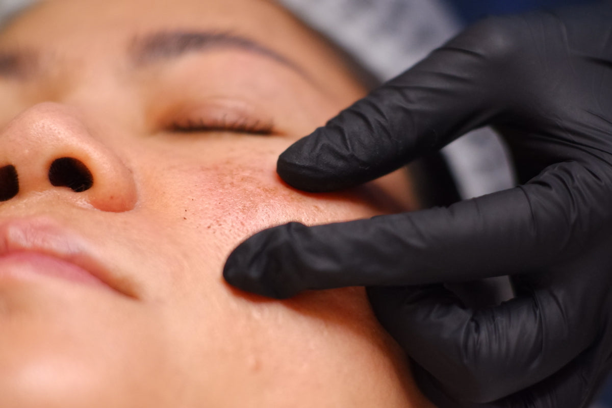 targeted area of skin issues