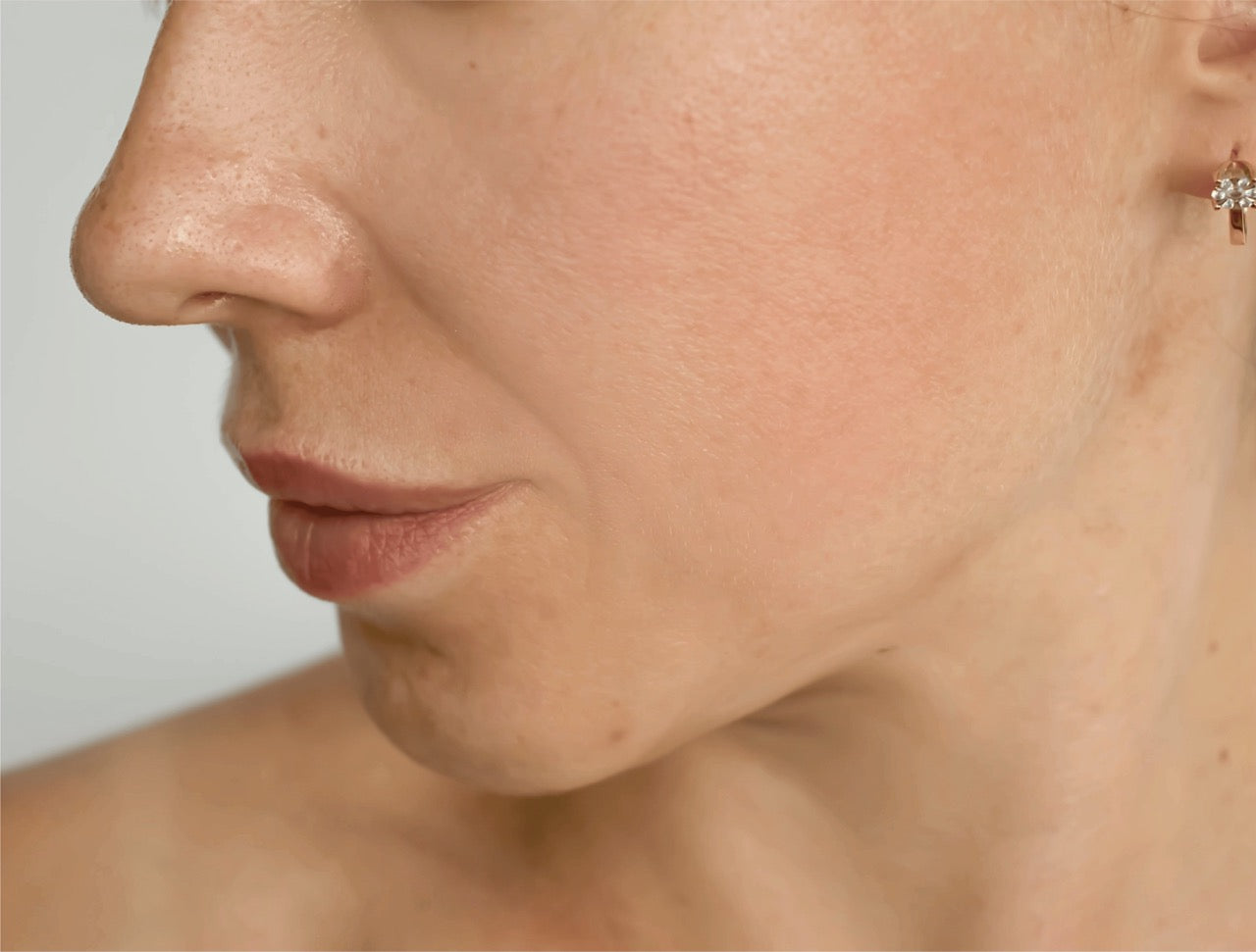 A close-up look of a woman during Sculptra treatment done by an expert resulting in improved facial volume at BROWZ in Dubai.
