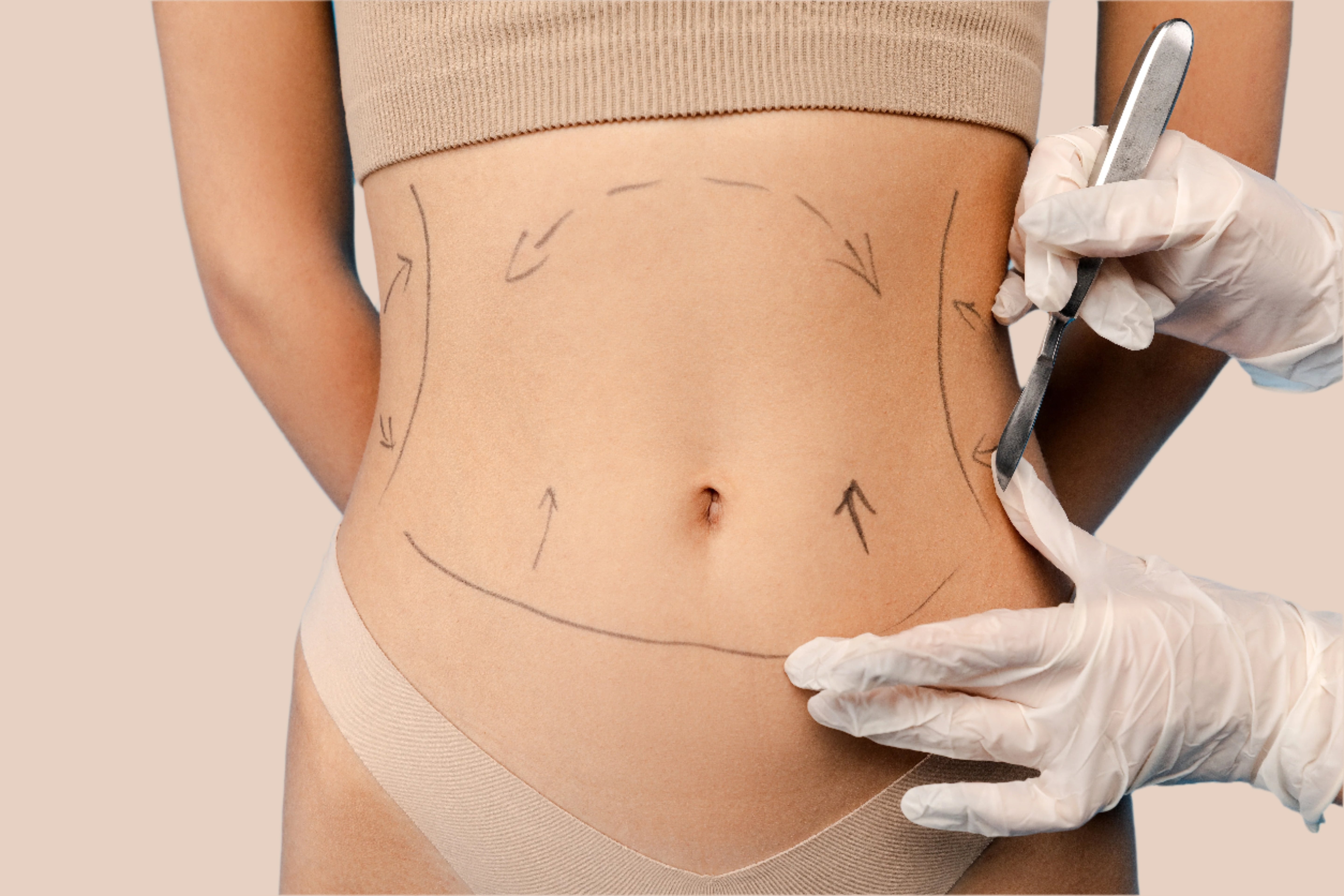 waist line liposuction surgery browz dubai