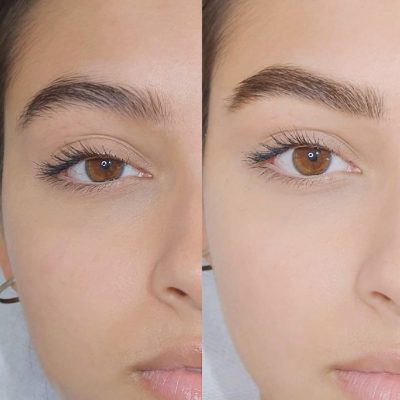 Microblading – Everything You Need To Know About Microblading Treatment