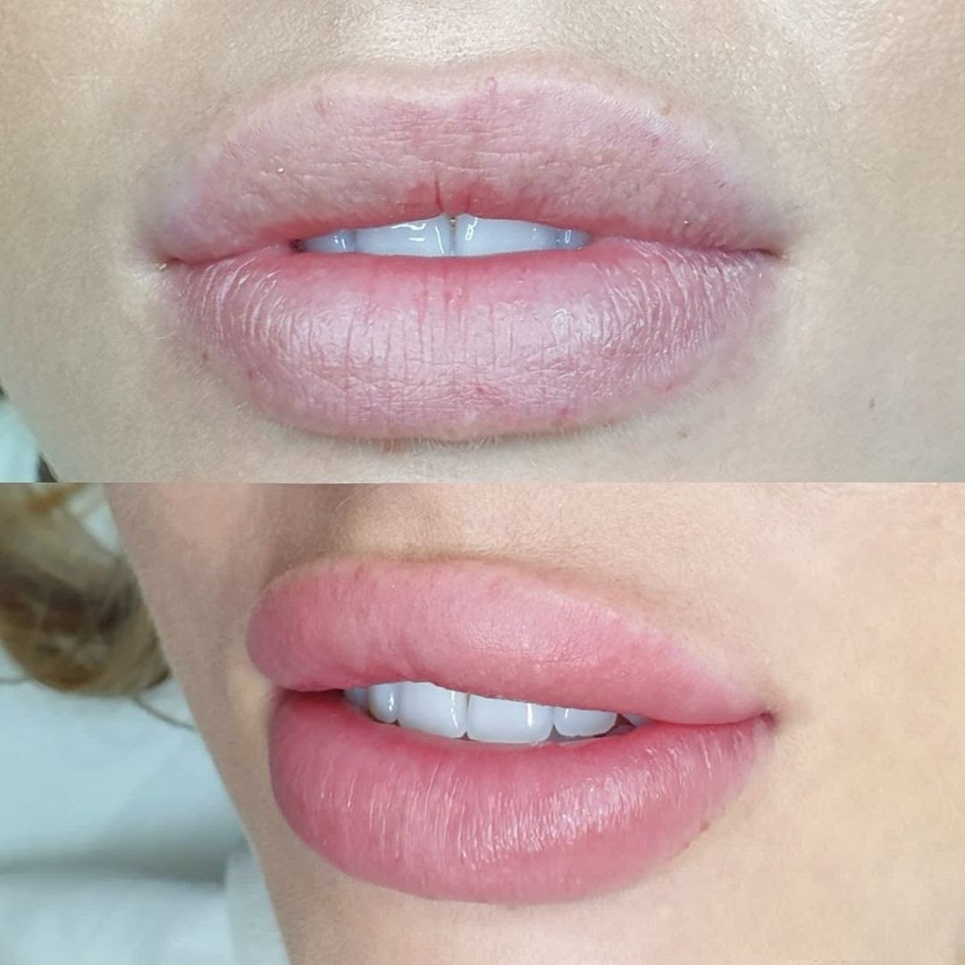 How Long Does Permanent Lip Color Last Lips Makeupview