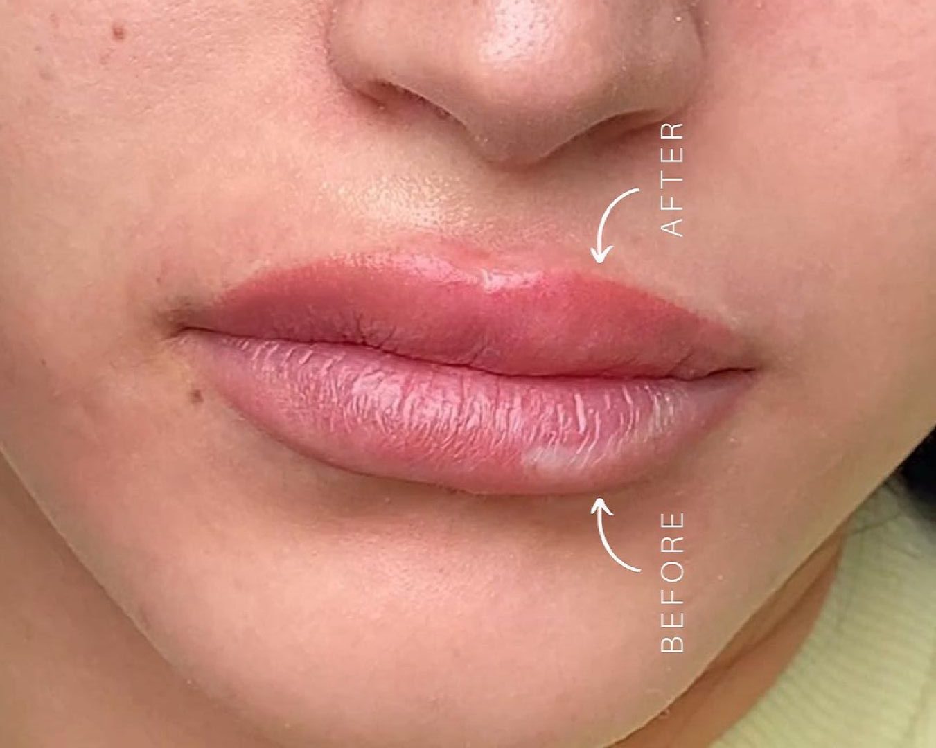 Benefits Of Semi Permanent Lip Blush